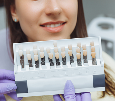 E-max Laminate Veneers