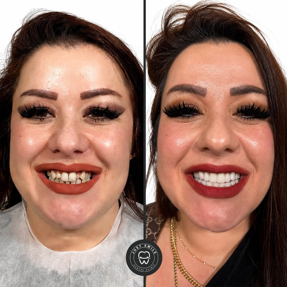 Emily T. Result