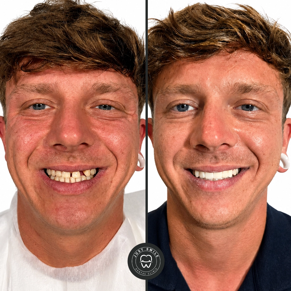 James P. Result