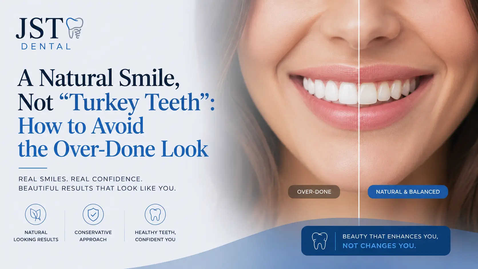 A Natural Smile, Not “Turkey Teeth”: How to Avoid the Over-Done Look