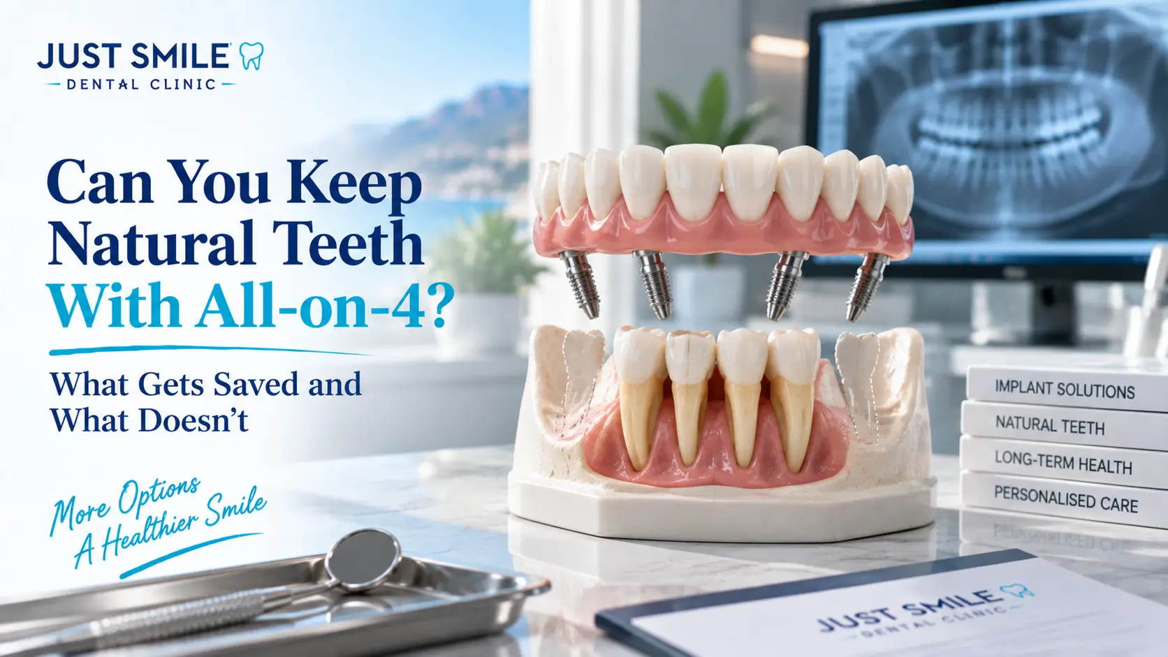 Can You Keep Natural Teeth With All-on-4? What Gets Saved and What Doesn’t
